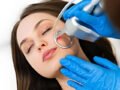 The Truth About CO2 Laser Resurfacing in South Surrey